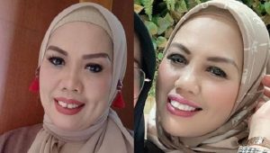 Ely Sugigi Potong Gigi; Banyak Mantan Saya Menyesal