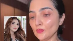 Wajah Ashanty Berubah, Publik Heboh: “Bukan karena Operasi, Aku Cuma Kurusan”