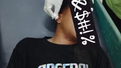 Gengster Kembali Berulah di Kota Probolinggo, Dua Pemuda Jadi Korban Pemukulan di Depan SPBU