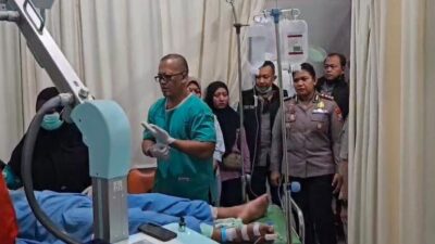 Empat Orang Tewas dalam Kebakaran di Bromo, Kapolres Jenguk Korban